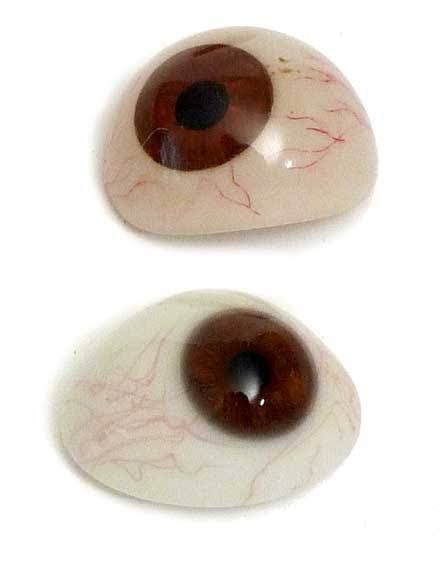 protesis-oculares-vision100-oftalmologos-monterrey